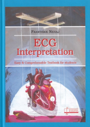 ECG  - Interpretation