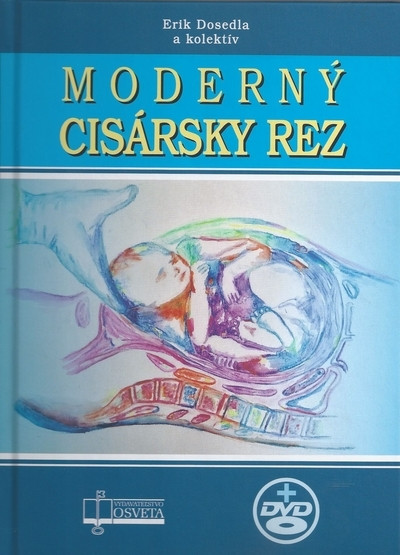 Moderný cisársky rez + CD