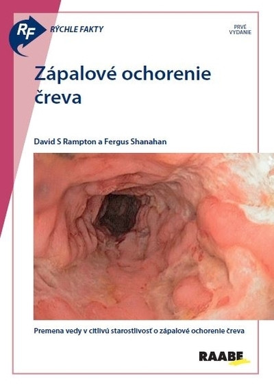 Rýchle fakty: Zápalové ochorenie čreva Rýchle fakty: Zápalové ochorenie čreva