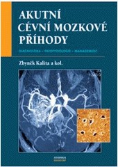 Akutní cévní mozkové příhody