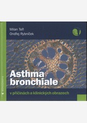 Asthma bronchiale v příčinách a klinických souvislostech 2.vydání Asthma bronchiale v příčinách a klinických souvislostech 2.vydání