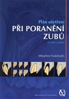 Plán ošetření při poranění zubů Plán ošetření při poranění zubů