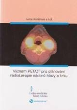 Význam PET/CT pro plánování radioterapie nádorů hlavy a krku