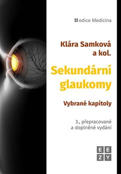 Sekundární glaukomy Sekundární glaukomy