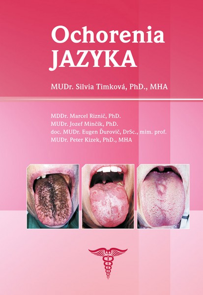 Ochorenia jazyka Ochorenia jazyka