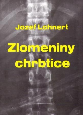 Zlomeniny chrbtice