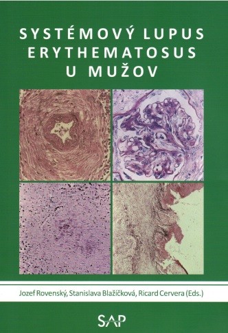 Systemovy lupus erythematosus u muzov Systemovy lupus erythematosus u muzov