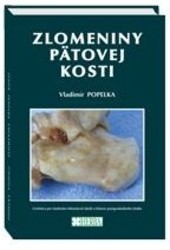 Zlomeniny pätovej kosti Zlomeniny pätovej kosti