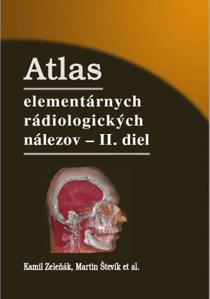 Atlas elementárnych rádiologických nálezov - II. diel Atlas elementárnych rádiologických nálezov - II. diel