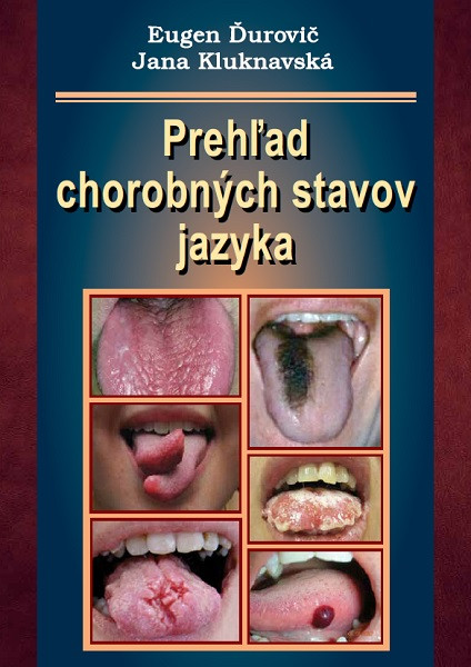 Prehľad chorobných stavov jazyka Prehľad chorobných stavov jazyka