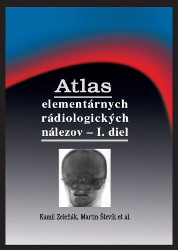 Atlas elementárnych rádiologických nálezov - I. diel (2.vydanie)