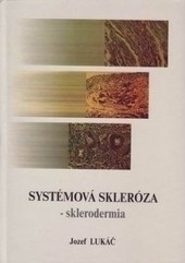 Systémová skleróza - sklerodermia Systémová skleróza - sklerodermia