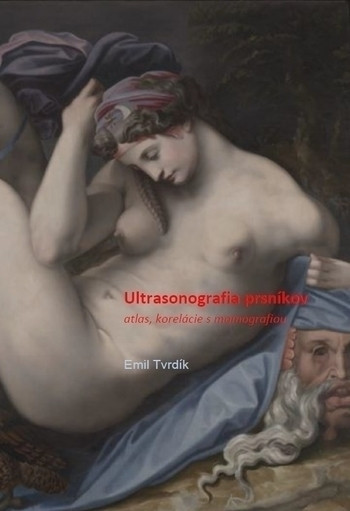 Ultrasonografia prsníkov + extra príloha Ultrasonografia prsníkov + extra príloha
