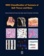 WHO Classification of Tumours of Soft Tissue and Bone WHO Classification of Tumours of Soft Tissue and Bone