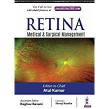 Retina