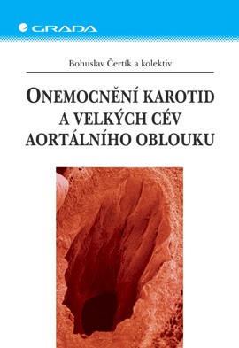 Onemocnění karotid a velkých cév aortálního oblouku Onemocnění karotid a velkých cév aortálního oblouku