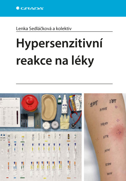 Hypersenzitivní reakce na léky Hypersenzitivní reakce na léky