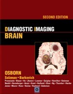 Diagnostic Imaging: Brain 2/e Diagnostic Imaging: Brain 2/e