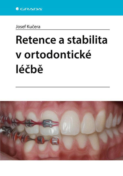 Retence a stabilita v ortodontické léčbě Retence a stabilita v ortodontické léčbě