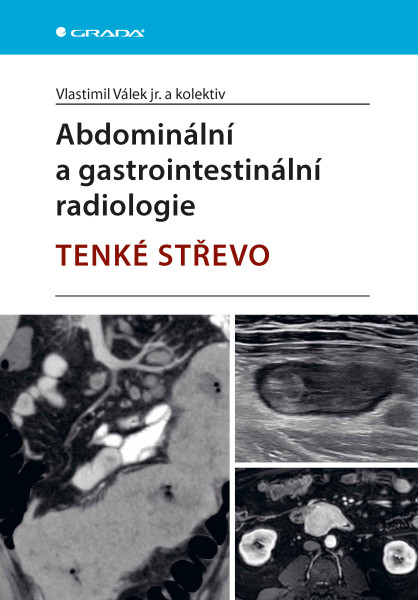 Abdominální a gastrointestinální radiologie Abdominální a gastrointestinální radiologie