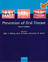 The Prevention of Oral Disease The Prevention of Oral Disease