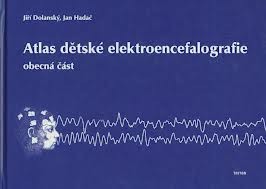 Atlas dětské elektroencefalografie obecná část Atlas dětské elektroencefalografie obecná část