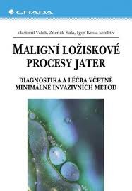 Maligní ložiskové procesy jater Maligní ložiskové procesy jater