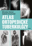 Atlas ortopedické tuberkulózy Atlas ortopedické tuberkulózy
