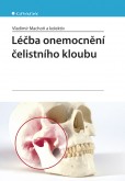 Léčba onemocnění čelistního kloubu Léčba onemocnění čelistního kloubu