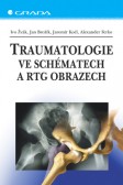 Traumatologie ve schématech a RTG obrazech Traumatologie ve schématech a RTG obrazech