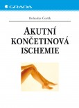 Akutní končetinová ischemie Akutní končetinová ischemie