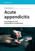 Acute appendicitis Acute appendicitis