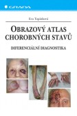 Obrazový atlas chorobných stavů Obrazový atlas chorobných stavů