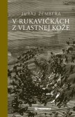 V rukavičkách z vlastnej kože V rukavičkách z vlastnej kože