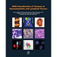 WHO classification of tumours of haematopoietic and lymphoid tissues