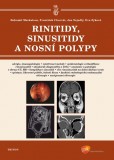 Rinitidy, sinusitidy a nosní polypy Rinitidy, sinusitidy a nosní polypy
