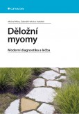 Děložní myomy Děložní myomy