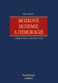 Mozkové ischemie a hemoragie Mozkové ischemie a hemoragie