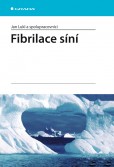 Fibrilace síní Fibrilace síní
