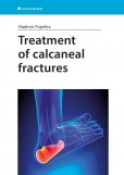 Treatment of calcaneal fractures