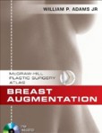 Breast Augmentation Breast Augmentation
