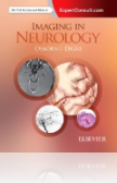 Imaging in Neurology
