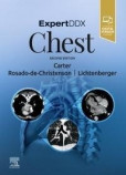 Chest Chest
