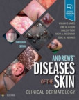 Andrews' Diseases of the Skin Andrews' Diseases of the Skin