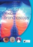 Atlas of Flexible Bronchoscopy Atlas of Flexible Bronchoscopy