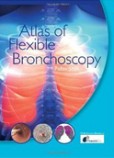 Atlas of Flexible Bronchoscopy