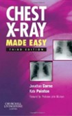 Chest X-Ray Made Easy Chest X-Ray Made Easy