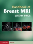 Handbook of Breast MRI Handbook of Breast MRI
