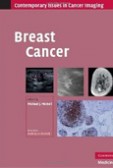 Breast Cancer Breast Cancer