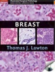 Breast Breast